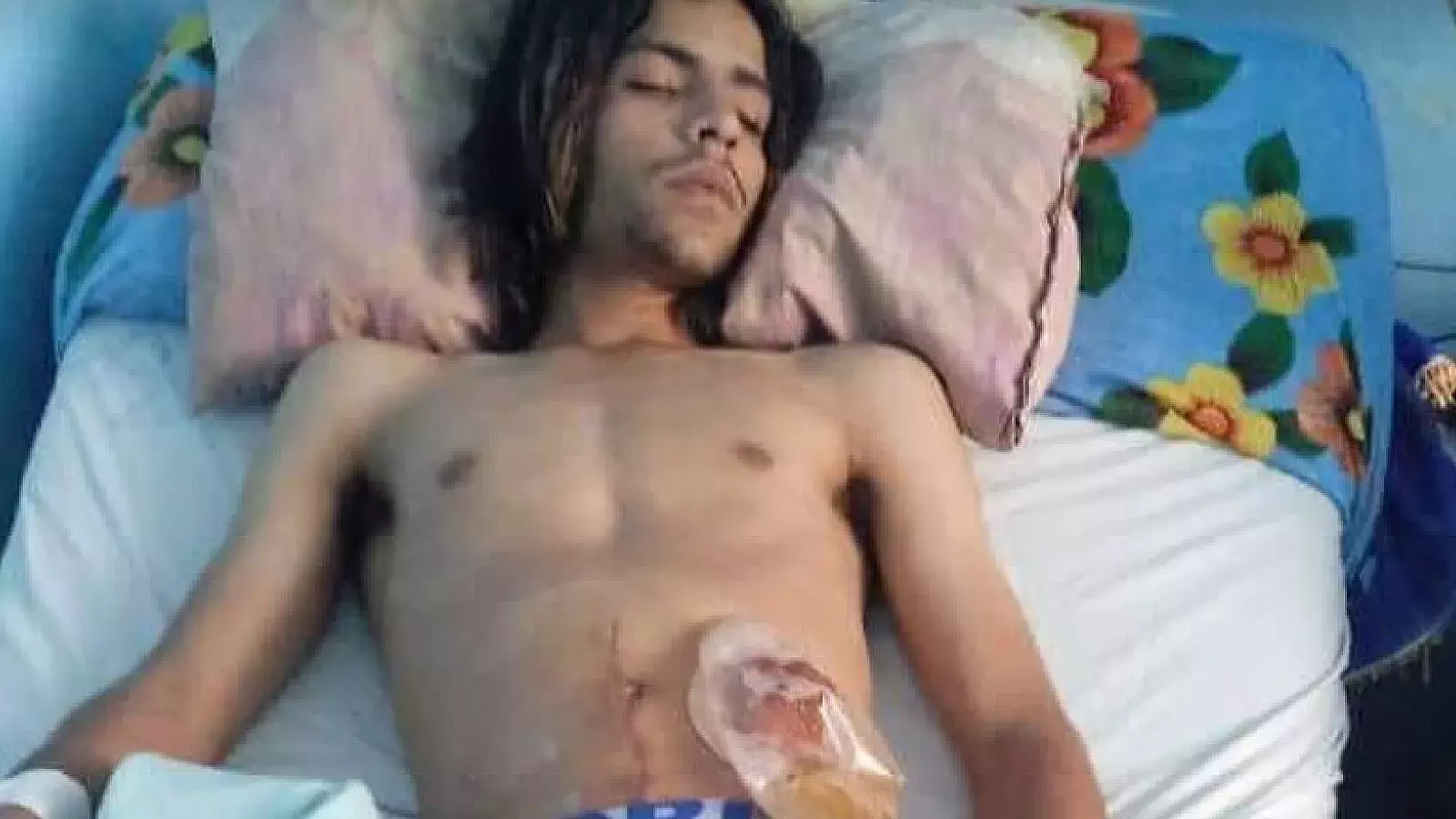 Piden ayuda para joven cubano