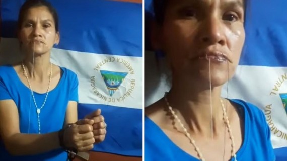 Madre cose sus labios por presos políticos