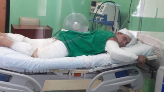 Matanzas "se olvidó de Yasmani", declara la esposa del chofer herido en incendio de Base de Supertanqueros